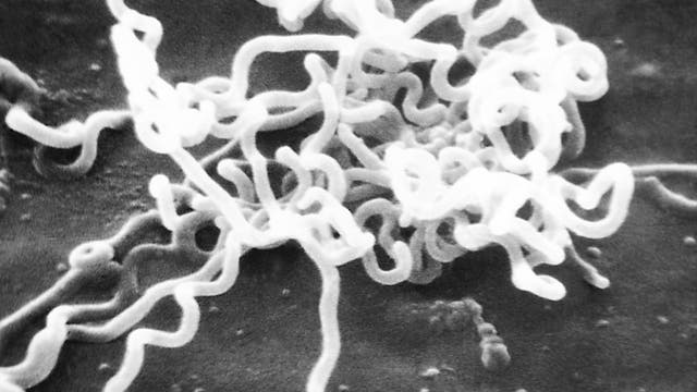 Elektrononmikroskopische Aufnahme des Syphilis-Erregers Treponema pallidum