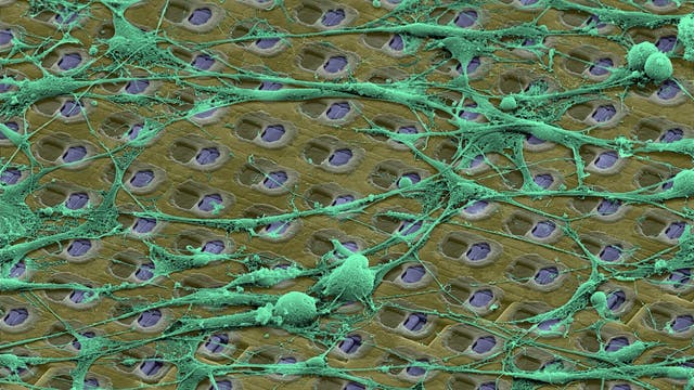 Neurone wachsen über Elektroden