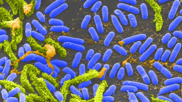 Rasterelektronenmikroskopische Aufnahme von Cholerabakterien (Vibrio cholerae; im Bild blau)