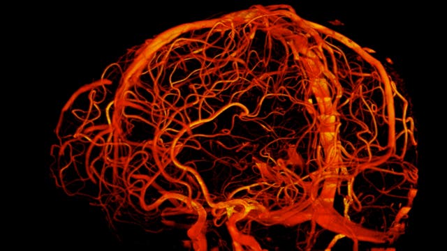 Blutgefäße im Gehirn (Sieben-Tesla-Tomograf)