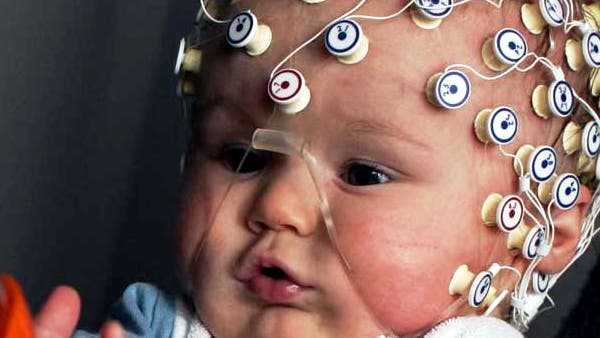 Baby mit EEG
