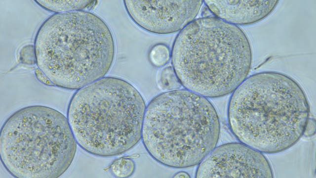 Ei- und Samenzellen