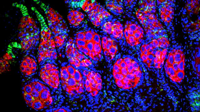 Wolbachia bevölkert die Nische für Keimbahnstammzellen im Eierstock weiblicher Taufliegen
