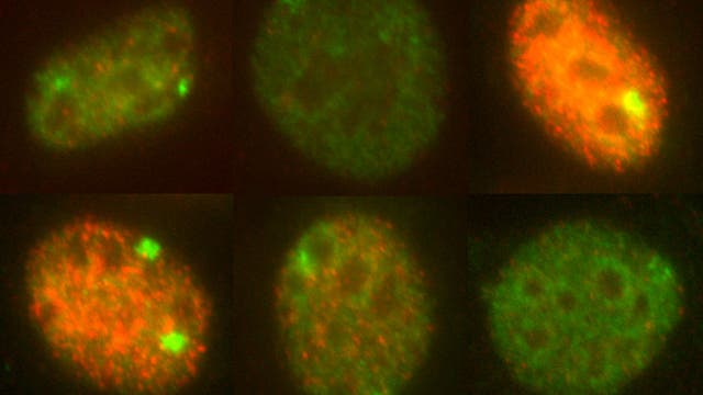 RNA-Regulation in weiblichen Zellen 