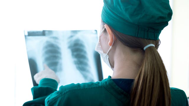 Ärztin begutachtet Röntgenbild einer menschlichen Lunge