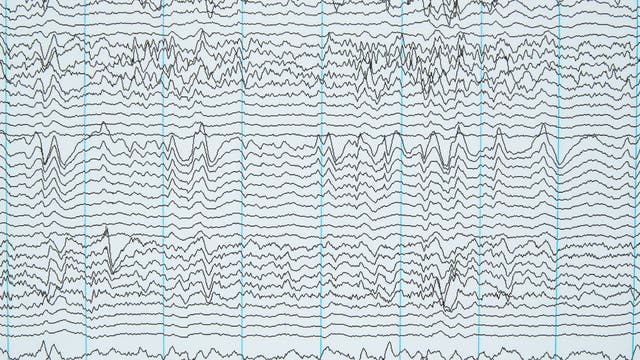 EEG-Wellen auf Papier