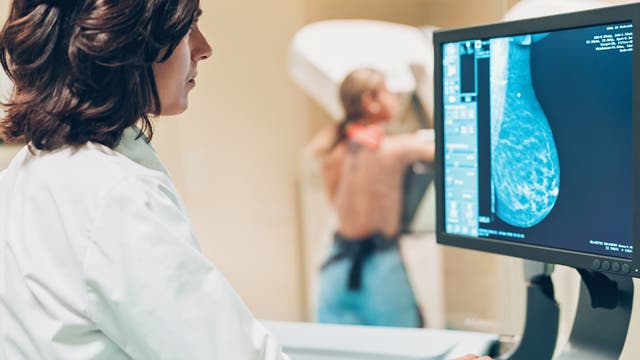Seit einigen Jahren gibt es in Deutschland ein gesetzliches Früherkennungsprogramm, das Mammografie-Screening für Frauen zwischen 50 und 69 Jahren. 
