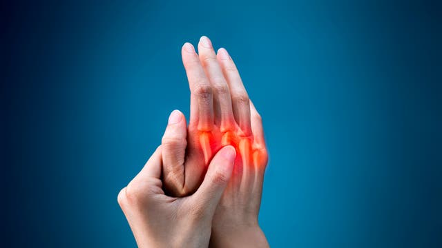Rheumatoide Arthritis fängt oft in den Finger- oder Zehengelenken an
