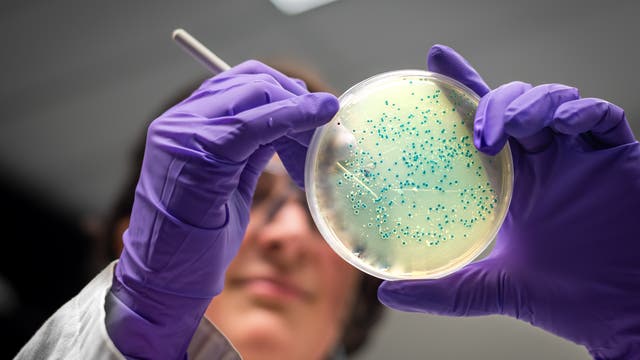 Eine Forscherin hält eine Petrischale mit Bakterienkultur in den Händen.