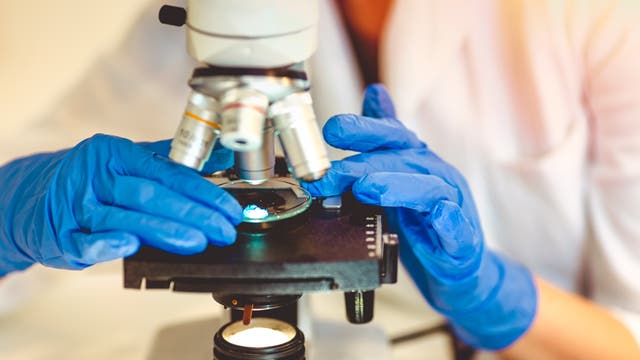 Bei einer Biopsie entnehmen Medizinerinnen und Mediziner eine Gewebeprobe, die sie im Labor von Spezialisten genauer untersuchen lassen.