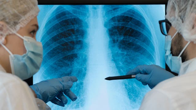 Ärzte besprechen Röntgenbild