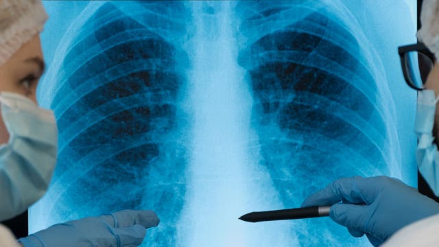 Ärzte besprechen Röntgenbild 