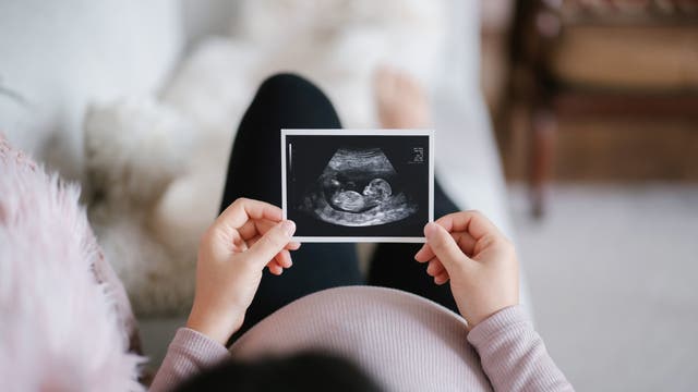 Eine werdende Mutter hält ein Ultraschallbild in der Hand
