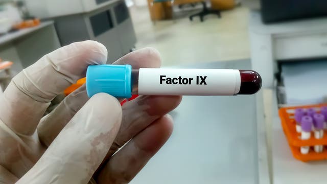 Ein Röhrchen mit einer Blutprobe für einen Blutgerinnungstest wird in einer Hand gehalten. Auf dem Röhrchen steht "Factor IX". 
