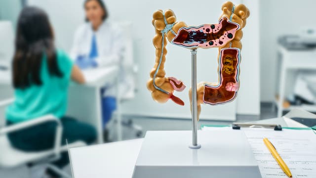 Anatomisches Darmmodell im Vordergrund. Im Hintergrund ist eine Ärztin im Gespräch mit einer Patientin. 