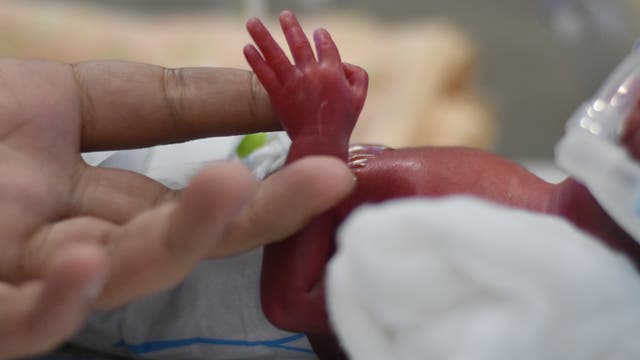 Ein Mann hält vorsichtig die sehr kleine Hand eines zu früh geboren Babys.