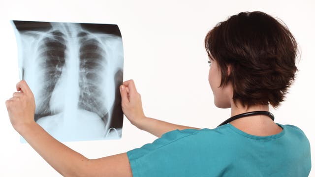 Eine Ärztin betrachtet eine Thorax-Röntgenaufnahme.