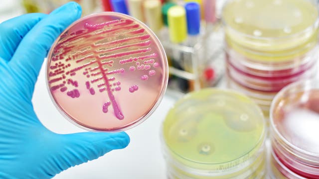 Mikrobiologische Proben in der Petrischale