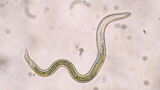 Larve des Spulwurms Toxocara canis unter dem Mikroskop.