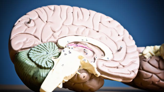 Ein Modell der rechten Gehirnhälfte. 