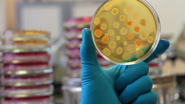 Bakterien auf einer Agarplatte in einer Petrischale