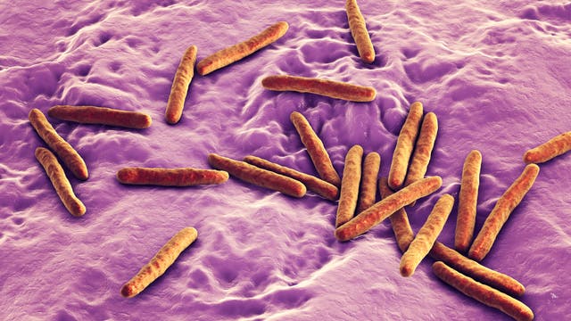 Stäbchenförmige Bakterien sorgen für Tuberkulose.