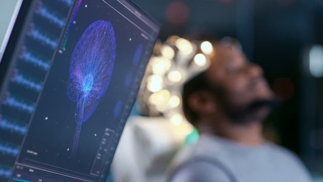 Ein Mann ist an ein EEG-Gerät angeschlossen, im Vordergrund ein Bildschirm mit Ansicht des Gehirns.