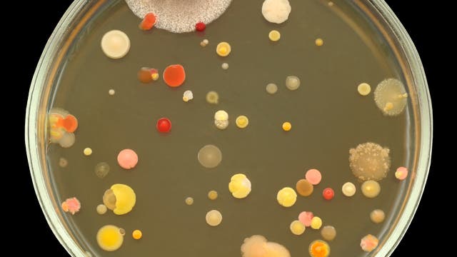 Bakterien- und Pilzkolonien