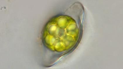 Sie sieht ein bisschen aus wie der Saturn - oder? Zumindest trägt <em>Saturnella saturnus</em>, eine Alge aus englischen Mooren, den Namen des Gasplaneten.