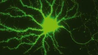Nervenzelle mit intakten Synapsen