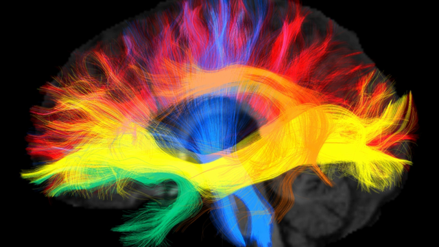 Per Computer erzeugtes Bild von Nervenfaserverbindungen im menschlichen Gehirn
