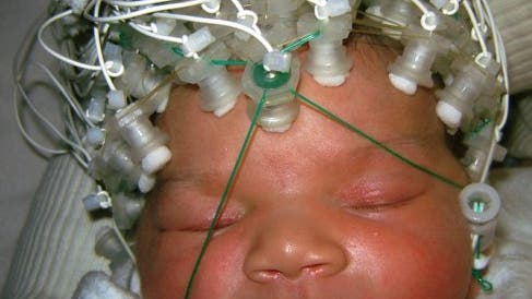 Neugeborenen-EEG