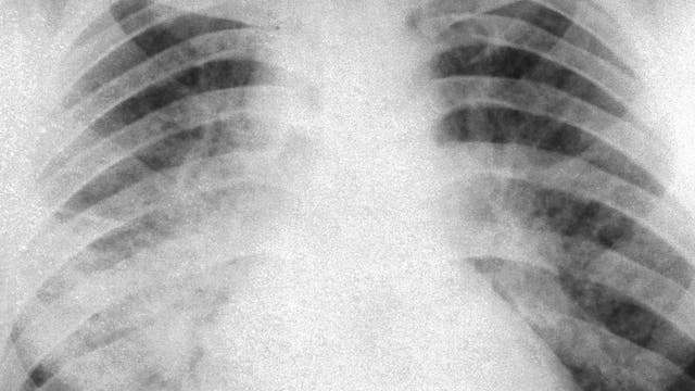 Röntgenbild von 1961
