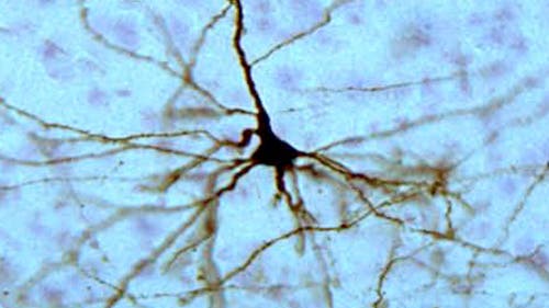 Neuron aus Stammzelle