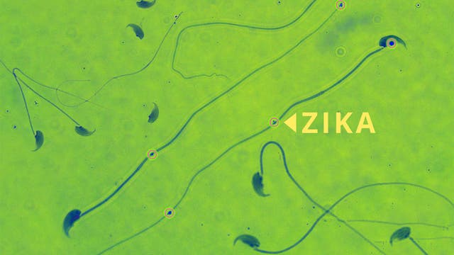 Zika in Spermien