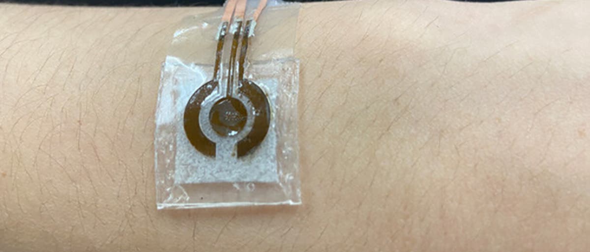 Glukosesensor Glukosesensor