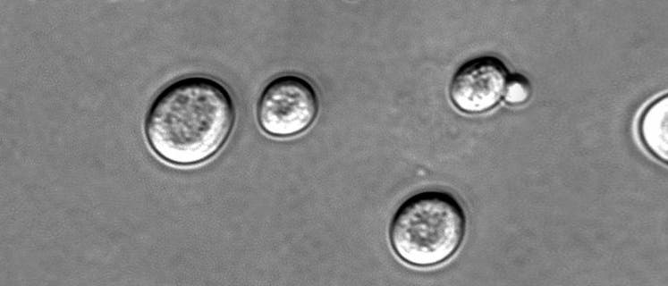 Saccharomyces cerevisiae Saccharomyces cerevisiae