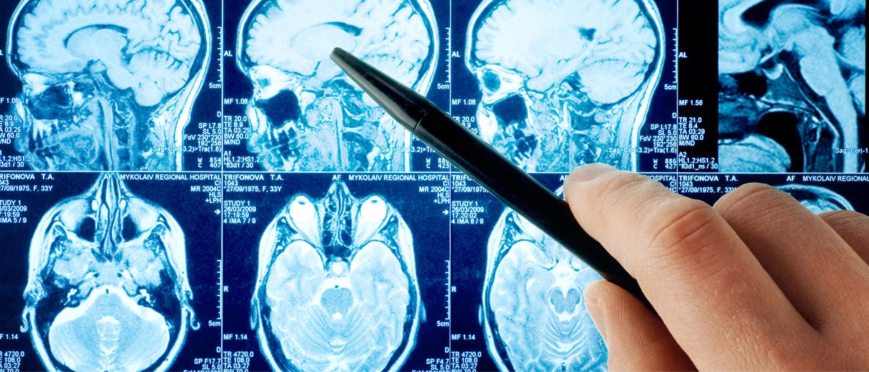 Hirnscans Hirnscans