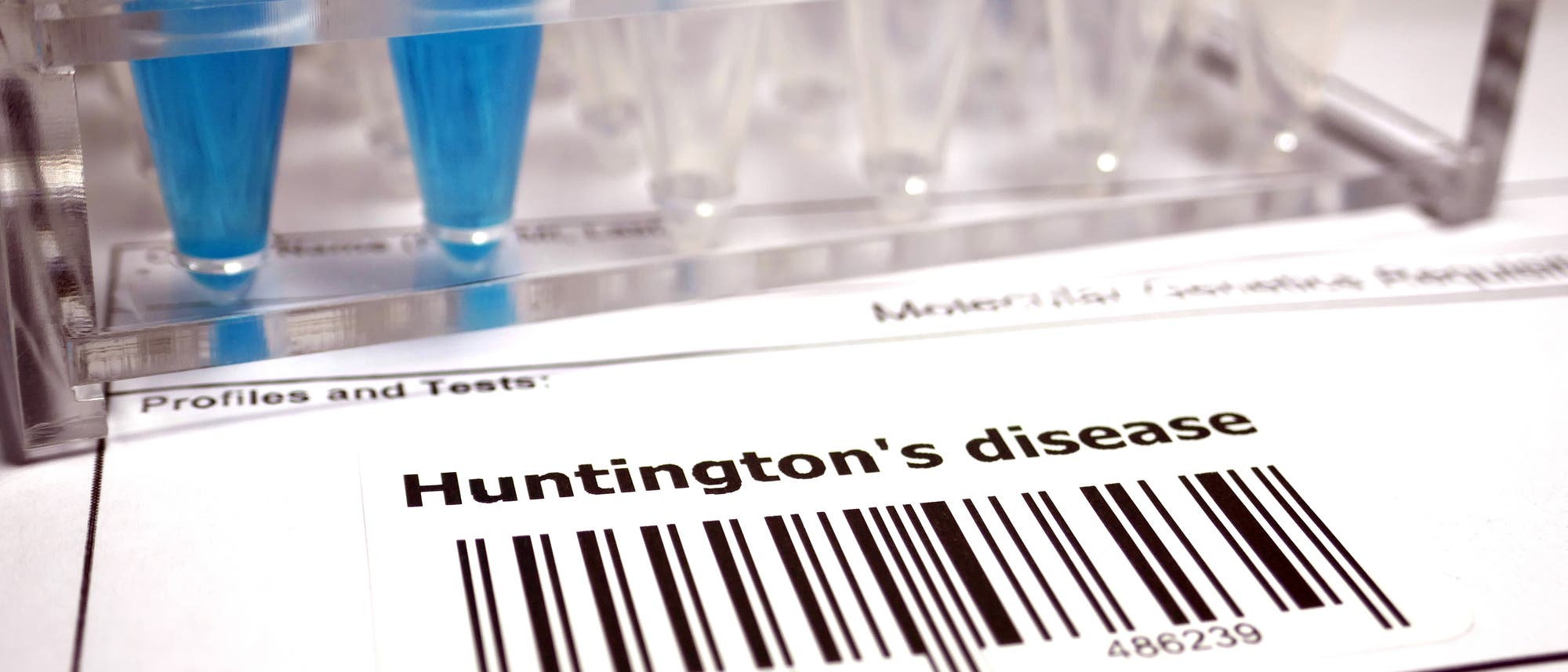 Huntington genetic test Huntington genetic test