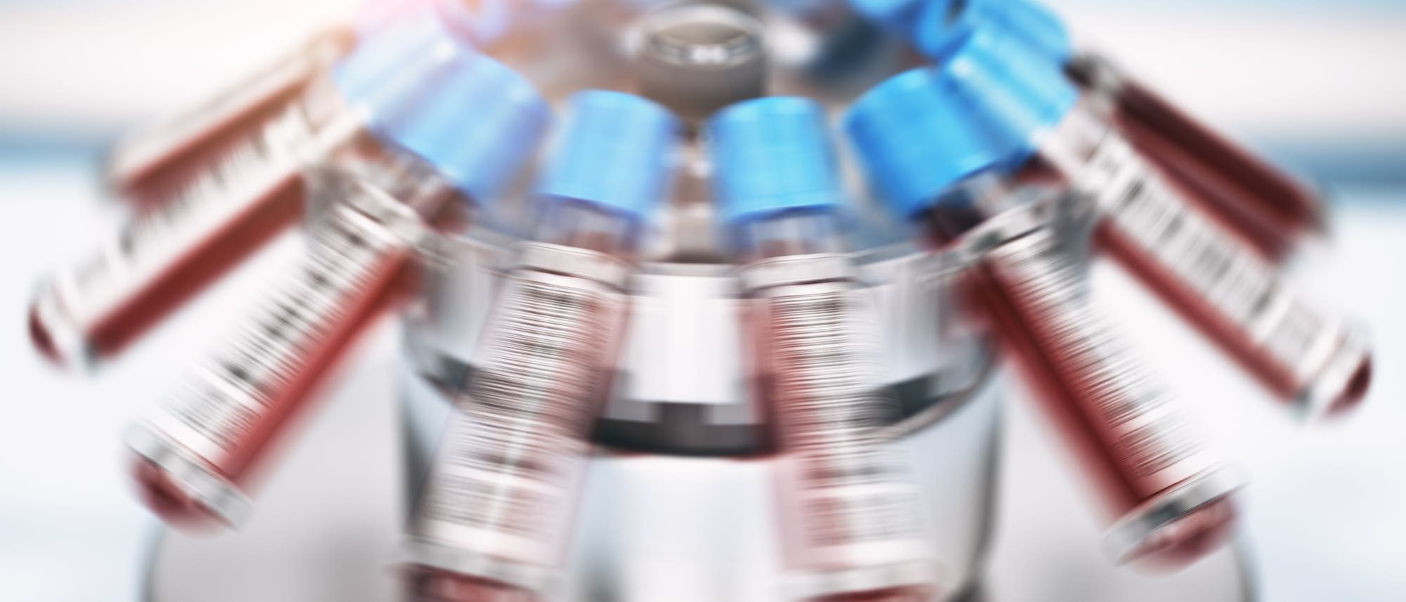 Blutproben werden abzentrifugiert Blutproben werden abzentrifugiert