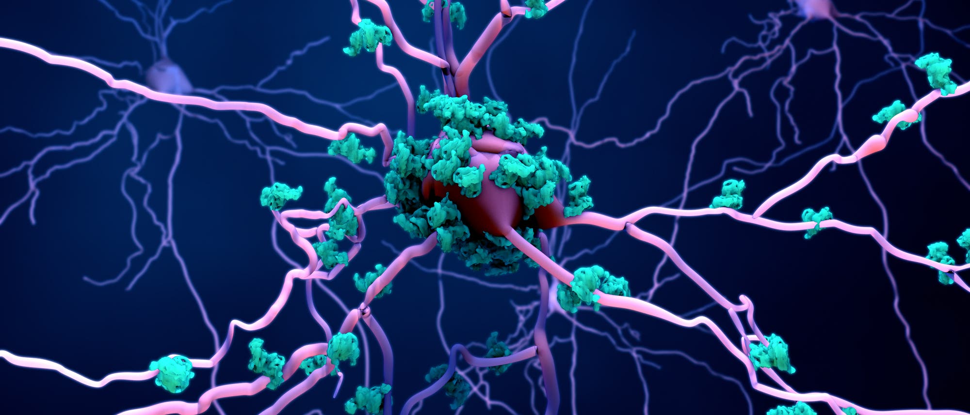 Beta-Amyloid an Neuronen Beta-Amyloid an Neuronen