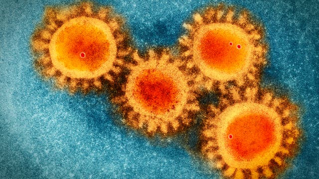 Eine mikroskopische Aufnahme zeigt das Coronavirus Sars-Cov-2.