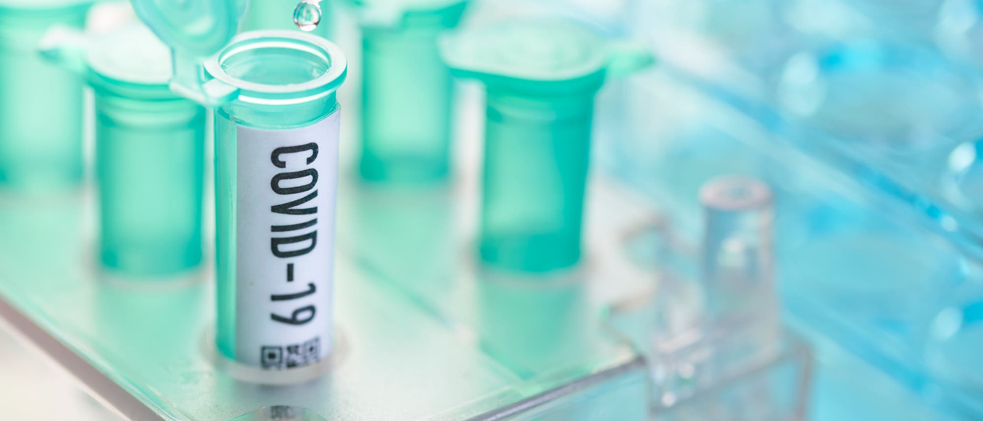 Labortests mit dem neuen Coronavirus. Labortests mit dem neuen Coronavirus.