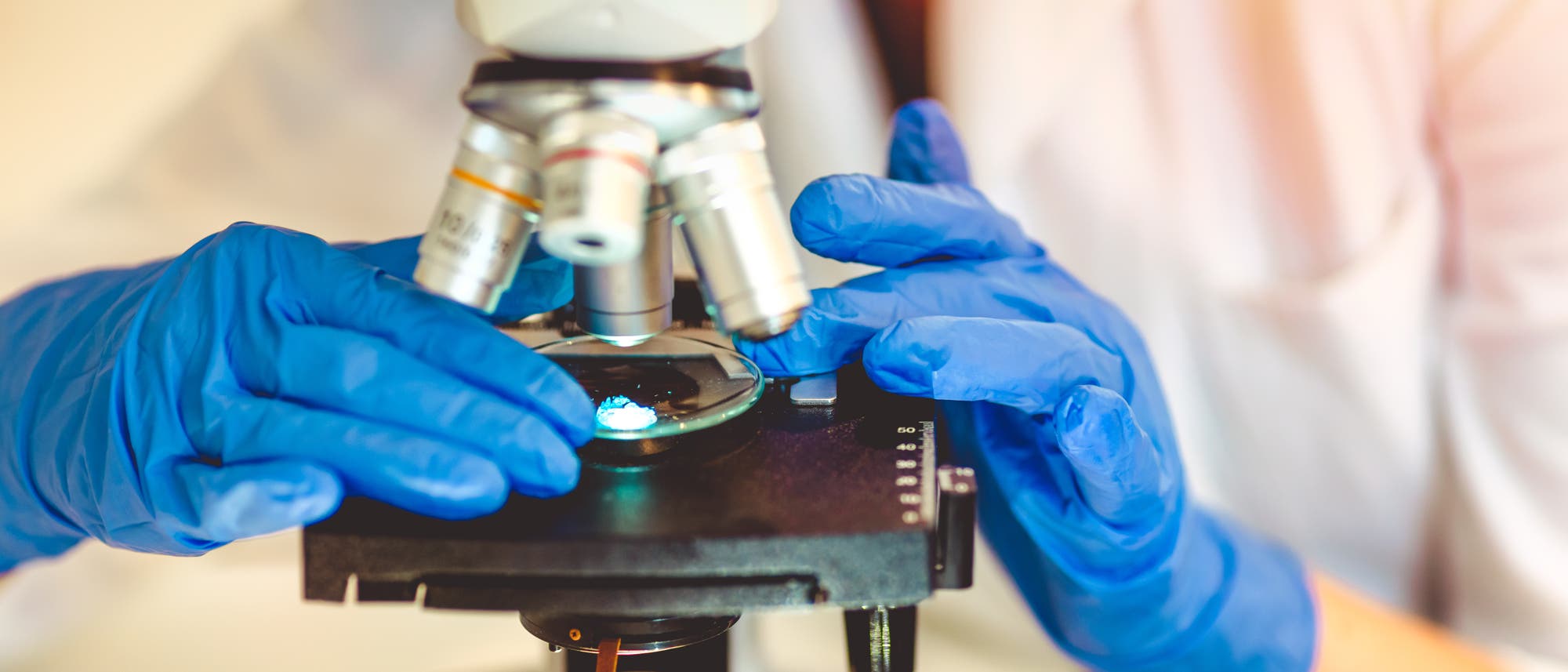 Bei einer Biopsie entnehmen Medizinerinnen und Mediziner eine Gewebeprobe, die sie im Labor von Spezialisten genauer untersuchen lassen. Bei einer Biopsie entnehmen Medizinerinnen und Mediziner eine Gewebeprobe, die sie im Labor von Spezialisten genauer untersuchen lassen.
