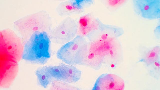 Plattenepithelzellen des Gebärmutterhalses unter Mikroskopansicht.
