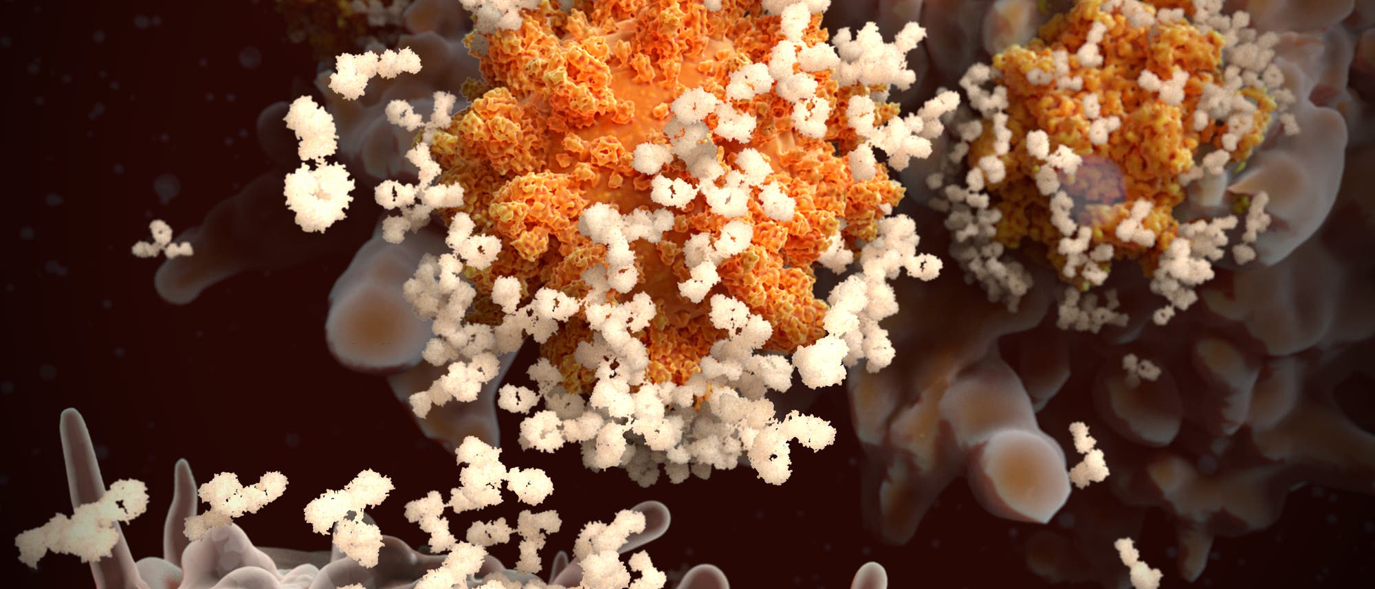 Die Illustration zeigt Antikörper, die sich an ein Sars-CoV-2-Virus binden Die Illustration zeigt Antikörper, die sich an ein Sars-CoV-2-Virus binden