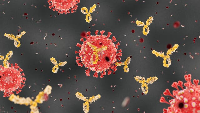 Schon früh in der Pandemie vermuteten Forscher, dass manche Menschen auf die Sars-Cov-2-Infektion mit einer überzogenen Immunantwort reagieren.
