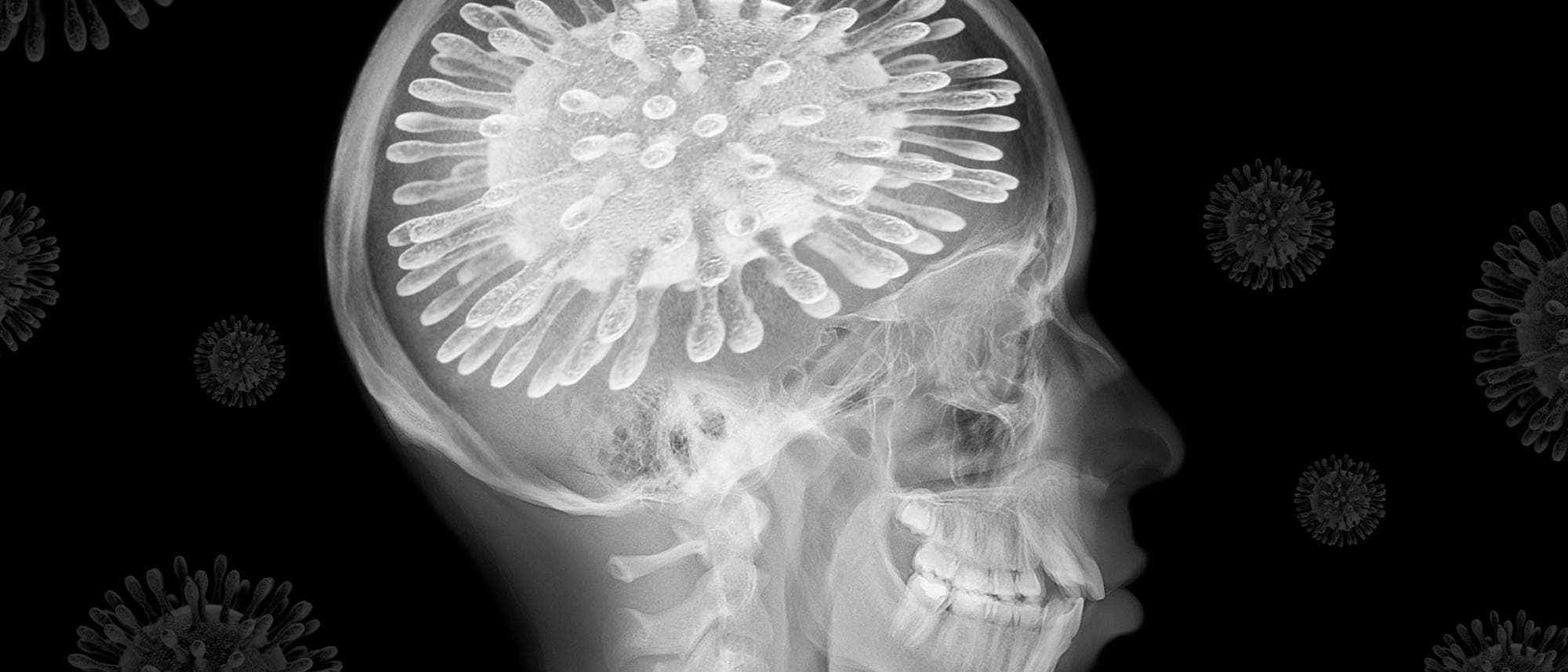 Schädel im Röntgenbild und stilisierten Coronaviren Schädel im Röntgenbild und stilisierten Coronaviren