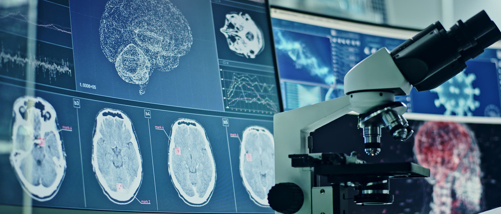 Computerbildschirme mit Hirnscans und ein Mikroskop im Vordergrund. Computerbildschirme mit Hirnscans und ein Mikroskop im Vordergrund.