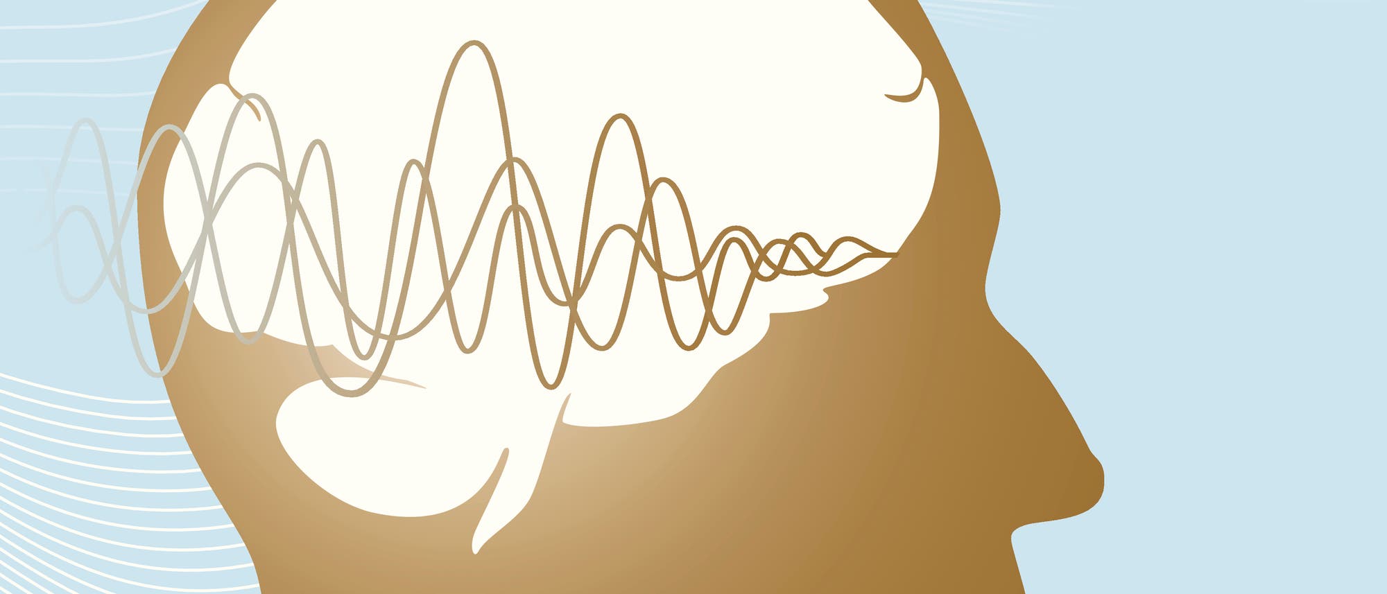 Wissenschaftler wollen neurologische Erkrankungen mit Ultraschall behandeln – doch zunächst müssen sie erforschen, wie die dabei verwendeten Wellen auf Nervenzellen wirken. Wissenschaftler wollen neurologische Erkrankungen mit Ultraschall behandeln – doch zunächst müssen sie erforschen, wie die dabei verwendeten Wellen auf Nervenzellen wirken.